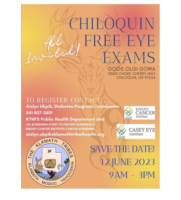 Chiloquin Free Eye Exams